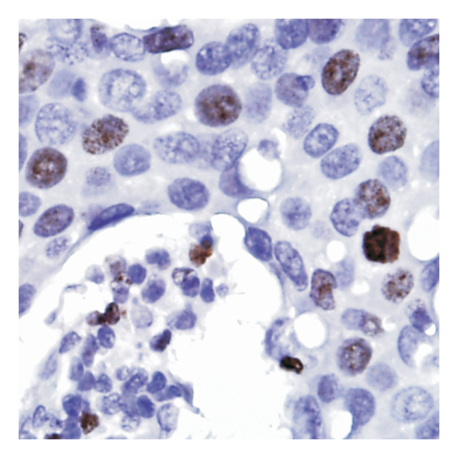 Lab Vision&trade; Ki-67, Rabbit Monoclonal Antibody