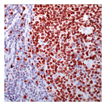 Lab Vision&trade; Ki-67, Rabbit Monoclonal Antibody