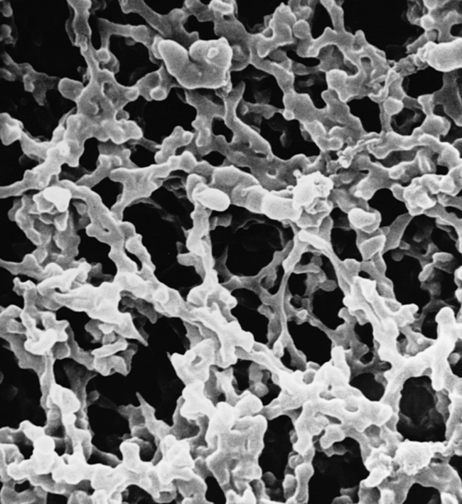 MF-Millipore&trade; Membrane Filter, 1.2 &mu;m