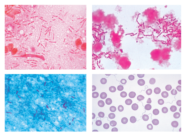 Pathogenic Bacteria