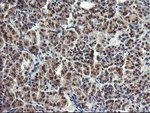 LYZ Mouse anti-Human, Clone: OTI1C9, lyophilized, TrueMAB&trade;