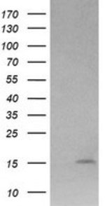LYZ Mouse anti-Human, Clone: OTI1C9, lyophilized, TrueMAB&trade;